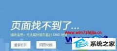 win10ϵͳʹѹʾ޷dnsַļ